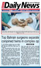 Top Bahrain Surgeons separate conjoined twins in complex op